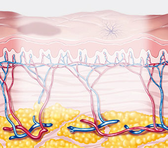滋賀県大津市・草津市でフォトフェイシャルステラM22(IPL)を提供しているぜぜ駅前ひふ科・形成外科クリニックの照射説明図(照射中)