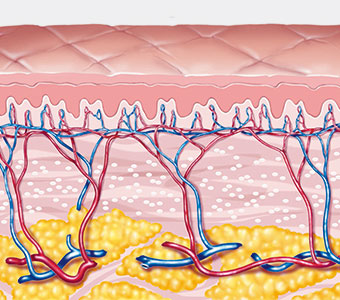 滋賀県大津市・草津市でフォトフェイシャルステラM22(IPL)を提供しているぜぜ駅前ひふ科・形成外科クリニックの照射説明図(照射後)